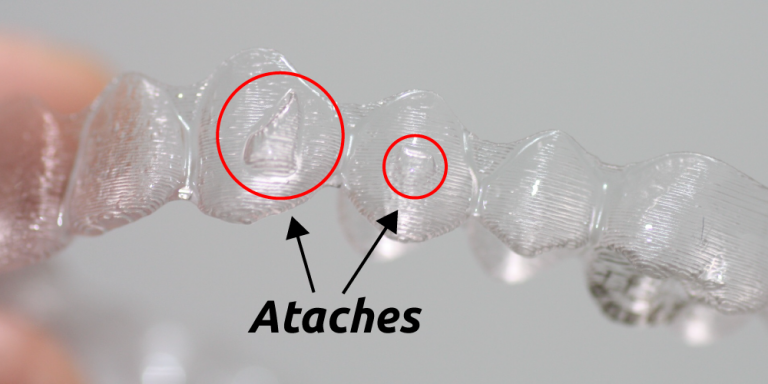 Ataches-Invisalign-768x384.png